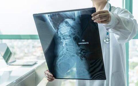 Sırt ağrıyorsa röntgen gerekli bir teşhis yöntemidir. 
